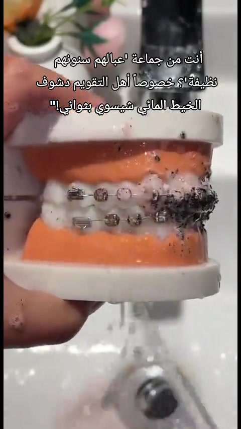 جهاز الخيط المائي،💯 Water flosser  لتنظيف الأسنان والعناية بها 🦷🦷 يزيل الترسبات والجير ورائحة الفم . ينصح به اطباء الأسنان لفعاليته في التنظيف العميق للجميع مفيد ايضا للتقويم وتركيبات الأسنان وأصحاب الابتسامة  شحن ⚡️⚡️ يدوم ل 30 يوم تقريبا شحن عن طريق شاحنة الهاتف ❤️ خزان ماء 350 مل يكفي لاستعمال كامل ❤️ انماط متعددة لدفع الماء مناسبة لجميع انواع اللثة ❤️ عدة رؤوس وعدة سرع تتحكم بيها مناسب للكبار وللأطفال ايضا بطارية 3500 مل امبير ايون ليثيوم تكفي شهر كامل الشحنة الواحدة ♥️ #تقويم_الاسنان #عناية_بالبشرة #ترند #لايك #اسنان 


**إذا كنت صاحب هذا الإعلان وتريد حذفه لأي سبب، رجاءا أرسل رسالة إلى الدعم الفني**