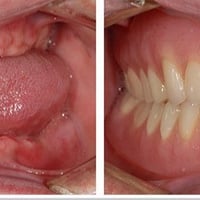 مجاناً الي فاقد جميع اسنانه أو جزء منهن وحاب يعوضهن بطقم كامل يراسلني ...