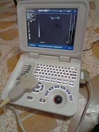 جهاز سونار • سونار • اجهزة طبية • معدات طبية • جهاز فحص