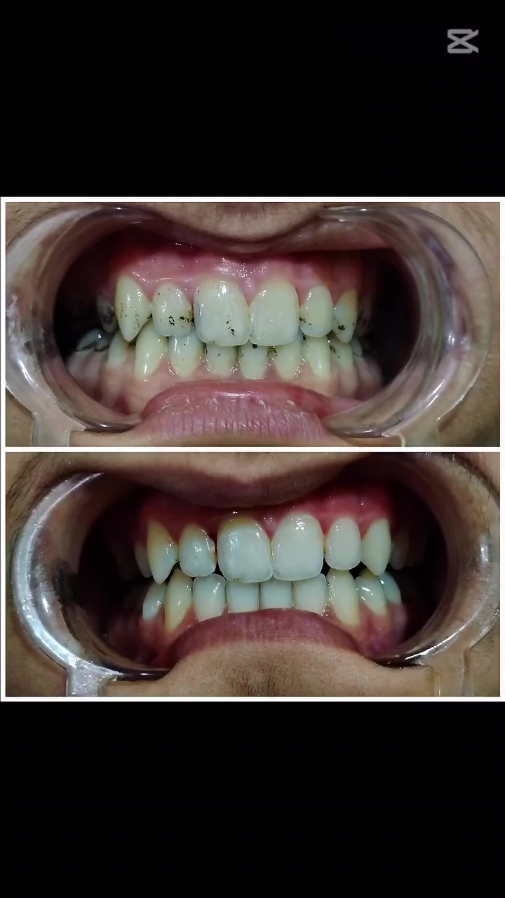 تنظيف وبولشنك للاسنان

للحجز :***********

العنوان :بعقوبة-التحرير الفلكة الاخيرة مقابل مركز صحي التحرير الثاني مجاور مجمع الهيبة العائلي

#اجعل_ابتسامتك_افضل #مع_عيادة_الدكتورةميس
