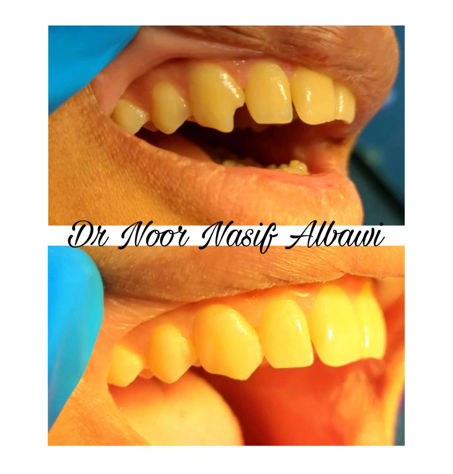 يعلن مركز الماس عن تواجد الدكتورة نور الباوي
في شهر رمضان ايام ( سبت / احد / اثنين / ثلاثاء) 
من الساعة ٧ الى ساعة ١٠ مساءا

📍بغداد / الحسينية / شارع الجريخي بناية مطعم جكن اوسلو سابقاً ( الطابق الارضي) 

للحجز والاستفسار 👈 ***********
