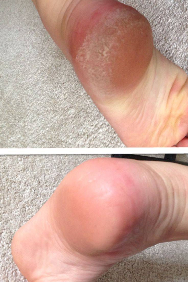 جددنه العروض علمودكم تدللون علينه 🥹🤏🏻
عروس حنه وزفه 225💃🏻💃🏻💃🏻
فقط زفه 125🎈💃🏻
فقط حنه 100🎎🔥🎉🎊🎈💃🏻
المدعوات 25🎊💃🏻🎈🎈
تنظيف البشرة مع المناكير والبدكير ب80 بس ☀
تنظيف البشرة ملكي ب25🎉
تنظيف  اليد 10🥳
حفافة 5
شمع للوجه  8
بديكير 20 مع املاح طبيعية 
الماكير 30🎈
سحب لون شعر قصير 15 واسط 20فما فوق حسب طول الشعر
صبغ شعر قصير جداً 15 💃🏻المتن 25 الوسط 30 الطويل حسب طول الشعر 
ميش كثيف قصير 20 فما فوق حسب طول الشعر 🎎🔥💃🏻
تسريح الشعر يخلي شعرج سرح حسب طول الشعر 
قص 5 اي قصه 
معالج لترميم وتغذية الشعر القصير 25 فما فوق حسب طول الشعر🎉🎊🎈
اهلا وسهلا بلجميع 
صالون الين
العنوان//كربلاء حي الرباب قرب سيد سماعيل 
الحجز //***********
***********
