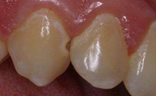 الي محتاج حشوه للاسنان للحالات الي موجوده بالصور أو تعويض الاسنان بطقم جزئي متحرك
او قلع الاسنان التالفه 
علما بان العلاج مجاني وتحت إشراف كادر طبي مختص 
العنوان جامعه الوطنيه مجاور ملعب التضحيه 
***********
