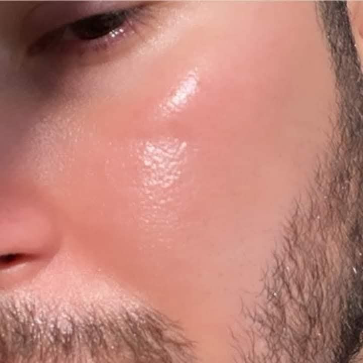 اقوى خلطة تبيض  وجه معجزه امانه الله 

اقوئ العروض وتخفيضات مده يومين تحطيم اسعار سعر جمله منتج يخبل والله العظيم

مخلوطه من18نوع من كريمات طبيه  بنوعيتين مسمن وبدون مسمن مورد وبدون مورد يستخدم للوجه والجسم بنفس وقت 
كلف نمش حب الشباب تصبغات هالات تحت العين  
  والاسعار ويانا نار 🔥

نتائج واضحة بيومين  من الاستعمال
فوائد الخـــلطــــــة

  ازالة التصبعات
- ازالة اكلف والنمش
- ازالة التجاعيد ( ان وجدت )
- ازالة هالات السوداء تحت العين 
-  تضيق المسامات
- ازالة حب الشباب  واثاره
🌹🌹🌹🌹🌹🌹🌹
خلال ثلاث ايام مفعول ملحوظ جدا 

امانه الله مجربه مضمونه وعن تجارب السعر ١٥توصيل مجاني 

الحجز مراسلة الصفحة
التوصيل مجاني لكافة محافظات العراق


**إذا كنت صاحب هذا الإعلان وتريد حذفه لأي سبب، رجاءا أرسل رسالة إلى الدعم الفني**