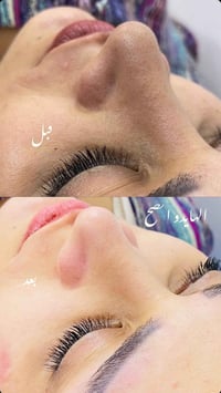 تنظيف بشرة عميق • صالون النجوم • شارع الشبكه