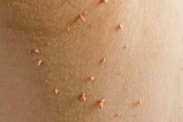 عيادة المتميزين التمريضيه (الرجال . والنساء )

🌸 إزالة الزوائد اللحمية الجلدية النسائية بكل أمان وراحة 🌸

هل تعانين  من الزوائد اللحمية و الجلديه 
🌸 إزالة الزوائد  اللحميه و الجلدية النسائية بكل أمان وراحة 🌸
الآن يمكنك التخلص منها بسهولة مع جلسة إزالة دقيقة وآمنة دون ألم يُذكر

✨ مميزات الخدمة:

إزالة سريعة خلال دقائق

بدون جراحة وبدون نزيف

أدوات معقمة ومعتمدة

خصوصية تامة للسيدات

نتائج فورية واستعادة الثقة من أول جلسة

✨ مناسبة لـ:
الزوائد الجلدية – الزوائد اللحمية – ( الرجال اي يوم )

📍 للسيدات فقط – حجوزات – سرية تامة
📞 للتواصل والحجز: (***********)
📆 م – موقع قريب من
 شارع الخليج بصف البنزين خانه الداخلية بصف همبركر خيري بصف همبركر حسوني بصف صيدلية ركن الخليج 

💗 لأن راحتك وجمالك أولويتنا 💗
