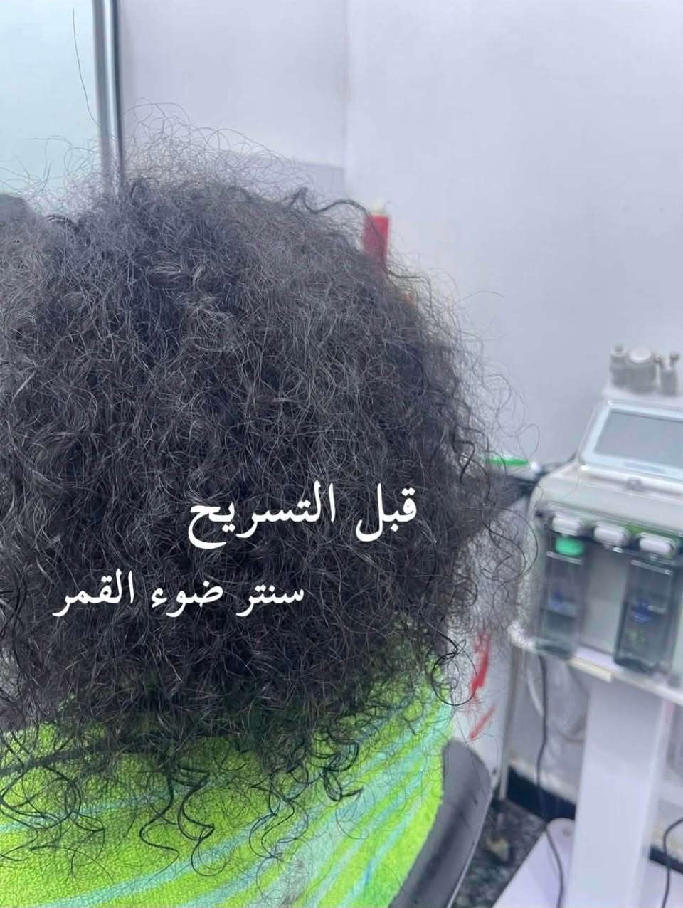 البعض يهتم السعر...
وإحنا نهتم بالنتيجة
مركز ضوء القمر 
💆🏻‍♀️ حف + تنظيف بشرة + شمع للوجه 5 آلاف
💇🏻‍♀️ تسريح 30 ألف
🎨 صبغ 10 آلاف
تنظيف بشرة+جلسة ديرمابن ب15 فقط
الرقم للاستفسار:***********
الدولعي الشارع العام مجاور ازياء الامير مباشرتاً
سنتر ضوء القمر
