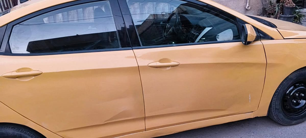 للبيع اكسنت موديل 2013 وارد امريكي حادث جاملق يمنة السعر 75$وبيهه مجال بسيط للاتصال على الرقم ***********
