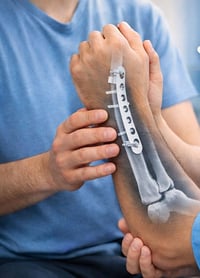 🔹 تحدد المفصل بعد عمليات تثبيت الكسور؟ العلاج الطبيعي هو الحل!  بعد عم...