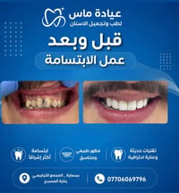 كُـلمــا زاد الوَقِــت 🚫 زادت التَكـلُفــه 🦷 بــادِر بِالكـــشِف علـى ...