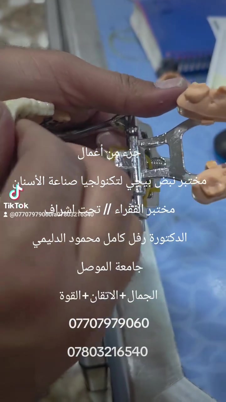 @أبرز المعجبين 
الجمال+الاتقان+القوة 
تكتمل في مختبر نبض بيجي لتكنلوجيا صناعة الاسنان 
مختبر الفقراء // تحت اشراف د. رفل جامعة الموصل
شوف العين يبري الذمة 
***********
***********
