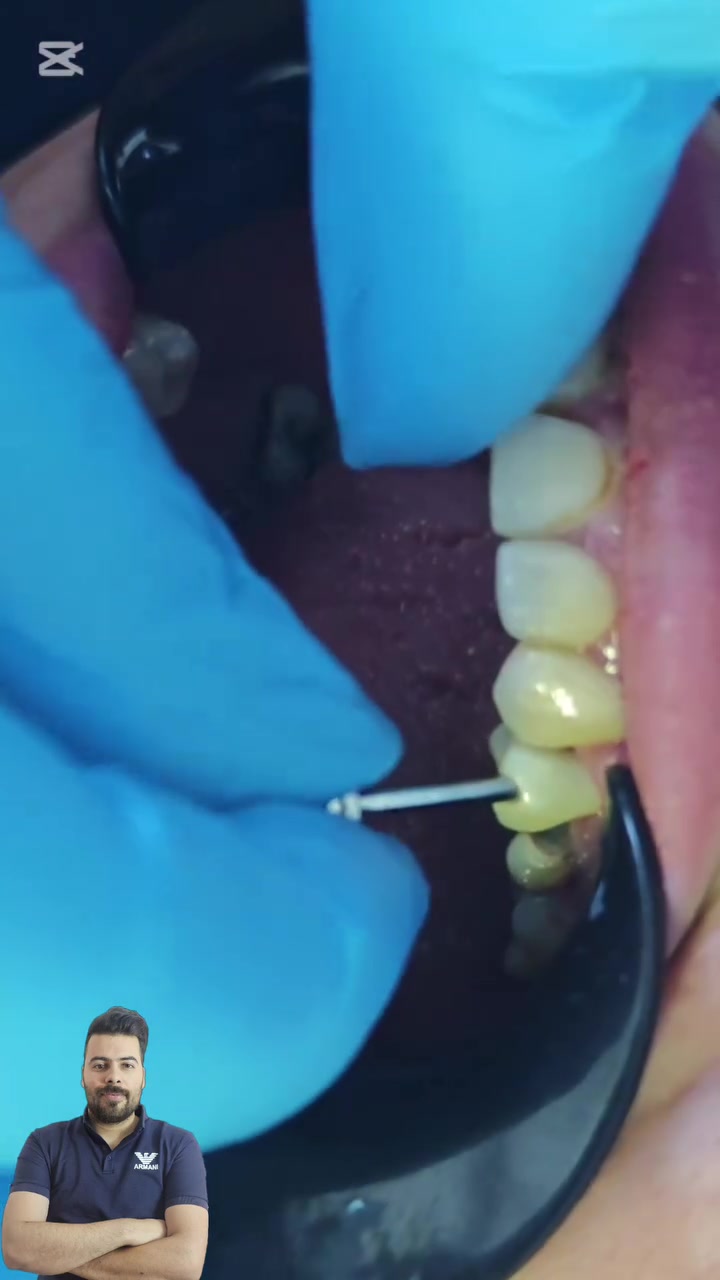 زرعنة سن ضاحك بلون مقارب للون الاسنان المجاورة

العنوان / المسيب / شارع البلدية / مجاور عالم الحليب

للحجز والاستفسار
***********
***********
