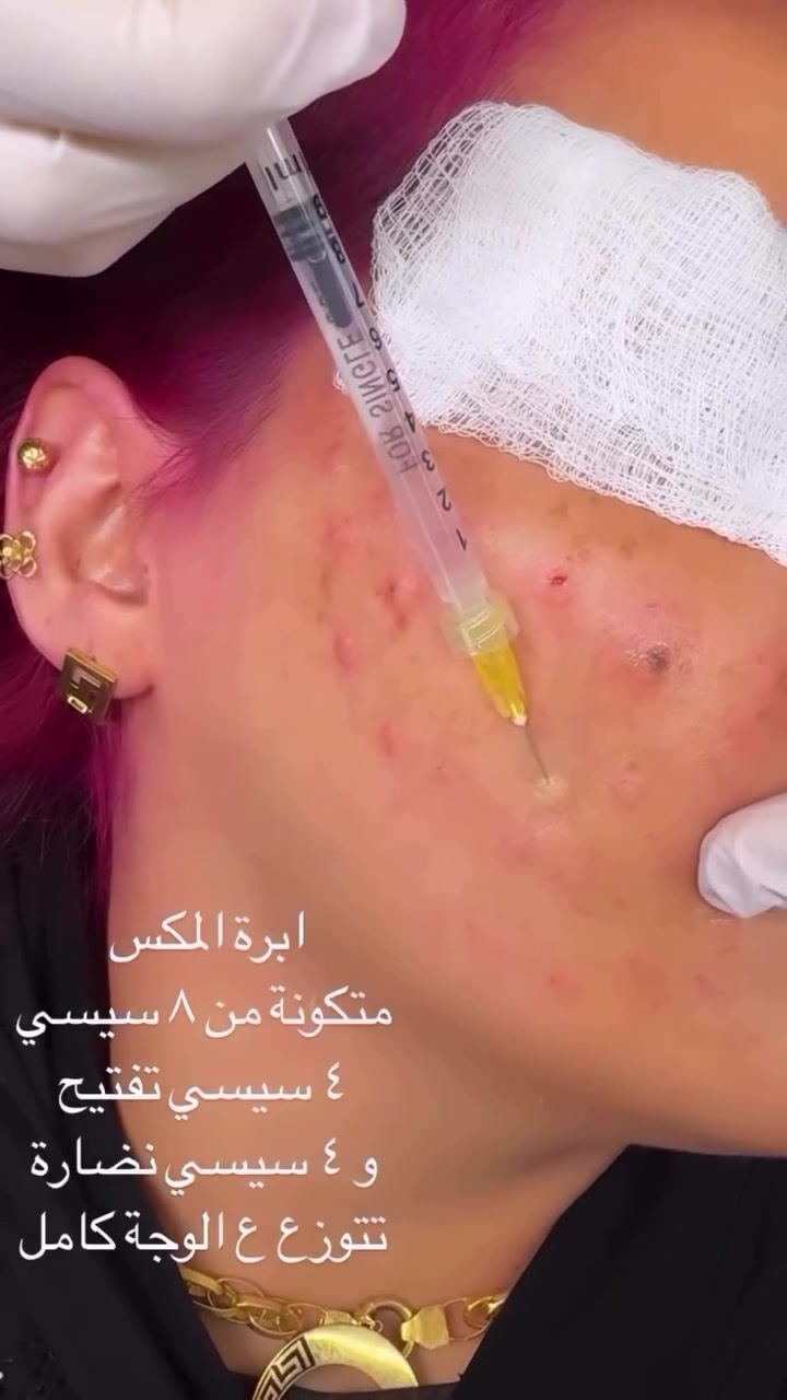 احلى رسمات الفلر على ايدي واستخدمنا للمراجعة فلر
 نيوفيا شنو رأيكم بالجمال 💓🥹

سويتلكم عرض على الفلر كلش قوية 💓

للاستفسار عن العروض والحجوزات والمعاينة على رقم الواتساب ***********

او على صفحة الفيسبوك 

او الانستكرام كلشي جديد ينزل بي https://www.instagram.com/p/DbWWdUhsNAt/?igsh=Z2EwenVjcm5rOXFu
