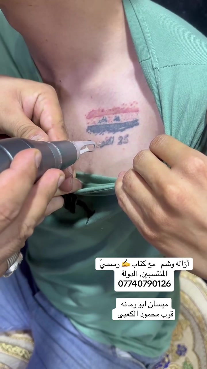 ازالة وشم  مع كتاب رسمي. وأنسب أسعار
ميسان. ابورمانه قرب محمودالكعبي 

***********

ابوجنه 💈
