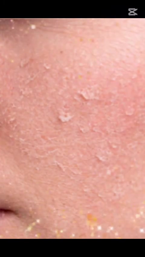 غدا يوم الاثنين 7/20الفحص مجانا مجانا 🥰🥀 
الزياره الاولى 
اخصائية الجلديه 
د اسيل سعيد عزيز 
للحجز والاستفسار وتساب 💌 
***********
