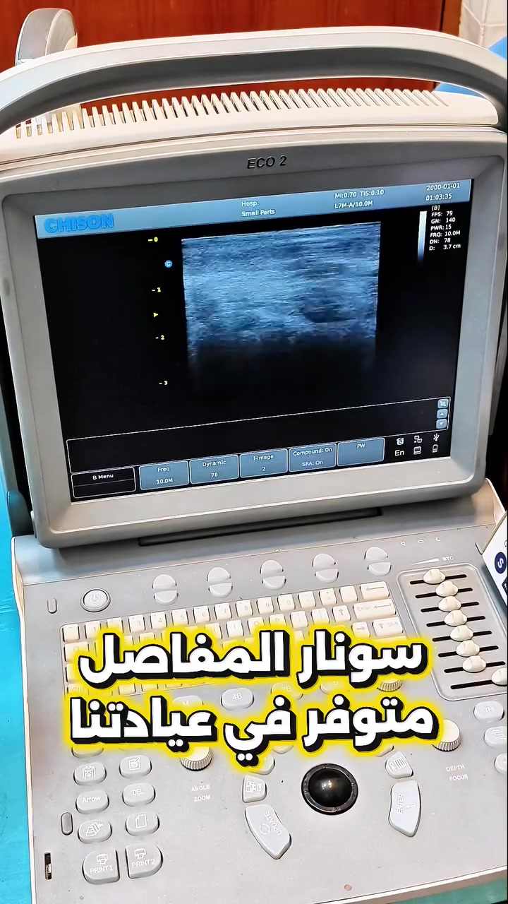 📍 سونار المفاصل متوفر في عيادتنا

فحص دقيق يساعدنا على تشخيص:
✔️ تجمع السوائل داخل المفصل
✔️ التهاب الأوتار والأربطة
✔️ تمزق الأوتار

👩‍⚕️ الدكتورة دينا وسام
اختصاص الأمراض الروماتيزمية والتأهيل الطبي

📍 العنوان: الشعب - شارع عدن - سوق شلال - مجاور مكوى الخضراء - عيادات الخضراء الطبية

🕓 أوقات الدوام (التوقيت الصيفي):
📅 السبت • الأحد • الثلاثاء • الأربعاء
من الساعة #تمزق_الأربطة  4:00 مساءً إلى 8:00 مساءً

📞 للحجز والاستفسار: ***********

https://maps.app.goo.gl/44SYzUy2UeGhGxTc7
