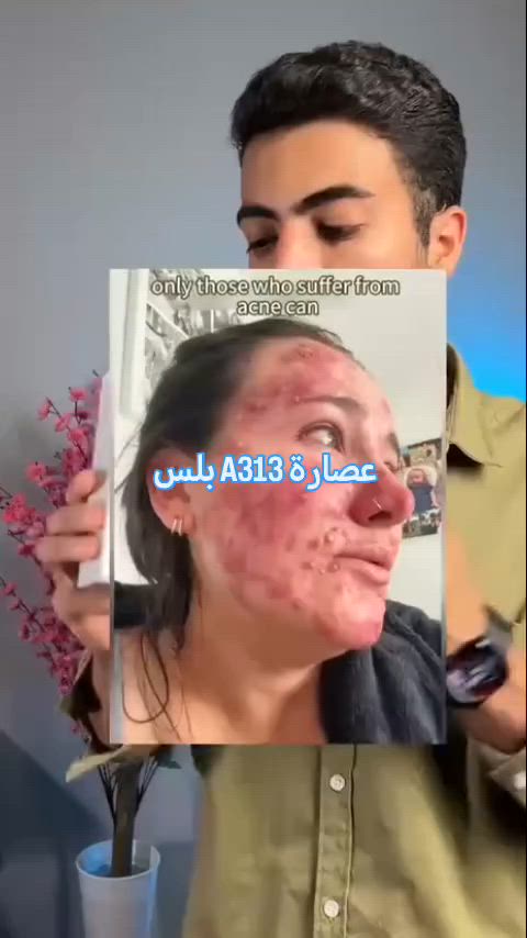 المنتج #الأكثر_طلباً واللي البنات دايماً يدورون عليه!
بديل الحقن للنضارة الفورية 💉✨
يعالج التصبغات، التجاعيد، وآثار التعب عالوجه!

🌟 عصارة A313 ريتينول الفرنسية 🇫🇷 – أقوى علاج لتجديد خلايا البشرة!
A313 Creme Au Palmitate De Retinyle Crème Correctrice

كريم فيتامين A 💊
الأطباء يوصون بيه لعلاج:
✅ تهيّج الجلد
✅ التجاعيد
✅ آثار الشمس
✅ حب الشباب
✅ التصبغات

شنو يسوي؟
🔹 يحفّز البشرة تنتج كولاجين
🔹 يسرّع تجديد خلايا الجلد
🔹 ينظّف المسامات ويقلل حجمها
🔹 يخلي بشرتج صافية، مشدودة، وبيها لمعة صحية ✨

💥 يعني بكل اختصار:
وجهج يرجع يلمع مثل المراية وبدون حقن أو فلتر! 😍

📍 ملاحظة مهمة:
ممنوع استخدامه للحامل أو المرضع ❌

#تصبغات #حبوب #علاج #عناية


**إذا كنت صاحب هذا الإعلان وتريد حذفه لأي سبب، رجاءا أرسل رسالة إلى الدعم الفني**