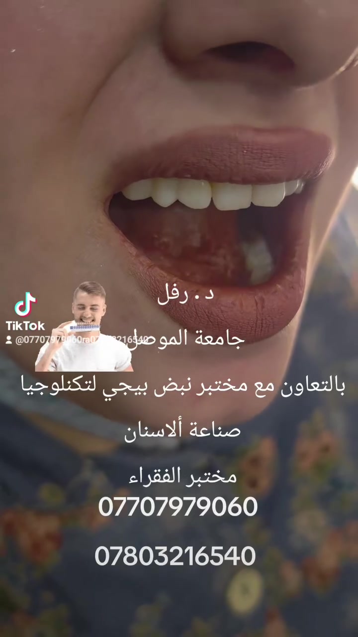 عياده طب الأسنان الدكتورة رفل كامل محمود 
***********
***********
استعيد ابتسامتك بثقة وجودة عالية مع احدث التقنيات في مجال الأسنان 
العنوان قضاء بيجي
 مجاور صيدلية نبض بيجيي
ومجاور مختبر نبض بيجي لتكنلوجيا صناعة الأسنان 
مختبر الفقراء
ابتسم معنا فبتسامتك غايتنا
