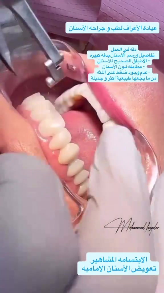 السلام عليكم
عياده الأعراف لطب وجراحة الأسنان 
لدكتور محمد الشمري 

متوجدين من الساعه ٤ عصرا لغايه ٩ مساءا 

موقع العياده بجانب عياده المصطفى للسونار  مقابل محل الملابس للزي العربي

أي استفسار هذا *********** بي واتساب

