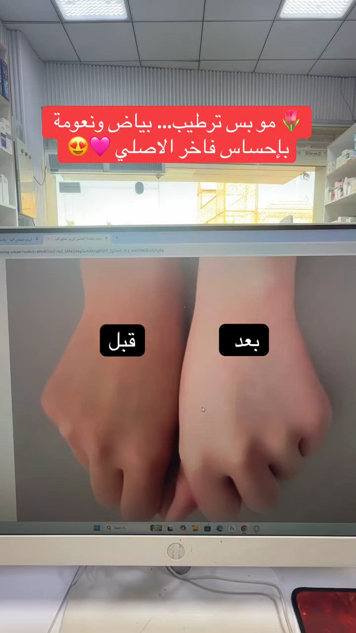 ✨🤍 لأن يديج تستحق البياض والنعومة! 🤍✨

🌸 استمتعي بإطلالة يدين أكثر إشراقاً وتوحيداً للون البشرة مع EVELINE White Prestige 4D.

💖 يساعد على:
✅ تفتيح مظهر اليدين تدريجياً
✅ تقليل مظهر البقع والتصبغات
✅ ترطيب عميق يدوم لساعات
✅ نعومة ولمسة حريرية من أول استخدام

🤲✨ بياض، ترطيب، ونعومة… بثلاث خطوات بكريم واحد!

📍متوفر لدى صيدلية وكوزمتك تكريت

أ


**إذا كنت صاحب هذا الإعلان وتريد حذفه لأي سبب، رجاءا أرسل رسالة إلى الدعم الفني**