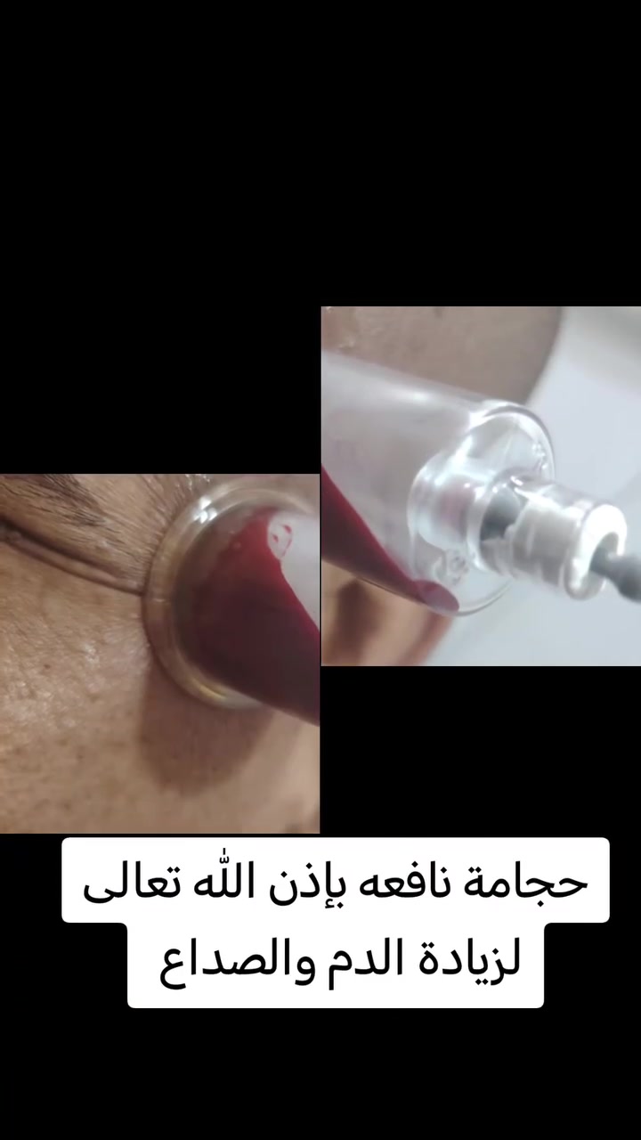 عنوانه ورديه خارج البونافع قرب مدرسه الميمونه الاتصال *********** اهلا وسهلا بالجميع
