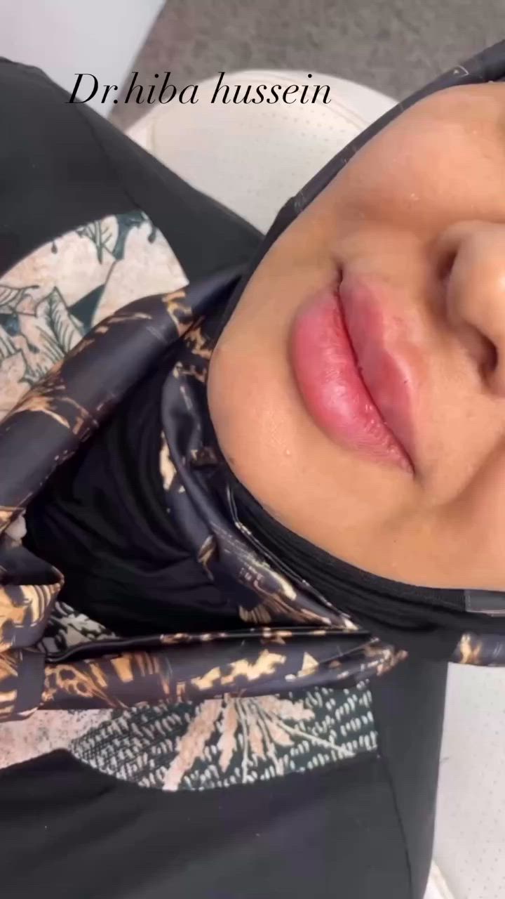 السلام عليكم
تتواجد الدكتورة هبة حسين داخل عيادة سنايا في شارع كفاءات السيدية (شارع كنانة) لتقديم خدمات التجميل اللاجراحي:
💉 حقن الفيلر�💉 حقن البوتوكس�💉 تحديد وإبراز ملامح الوجه�💉 علاج الخطوط والتجاعيد
بأسعار رمزية ومناسبة لفترة محدودة.
📞 للحجز والاستفسار يرجى التواصل مسبقاً وحجز موعد قبل المراجعة ***********
أهلاً وسهلاً بكم 🌷
