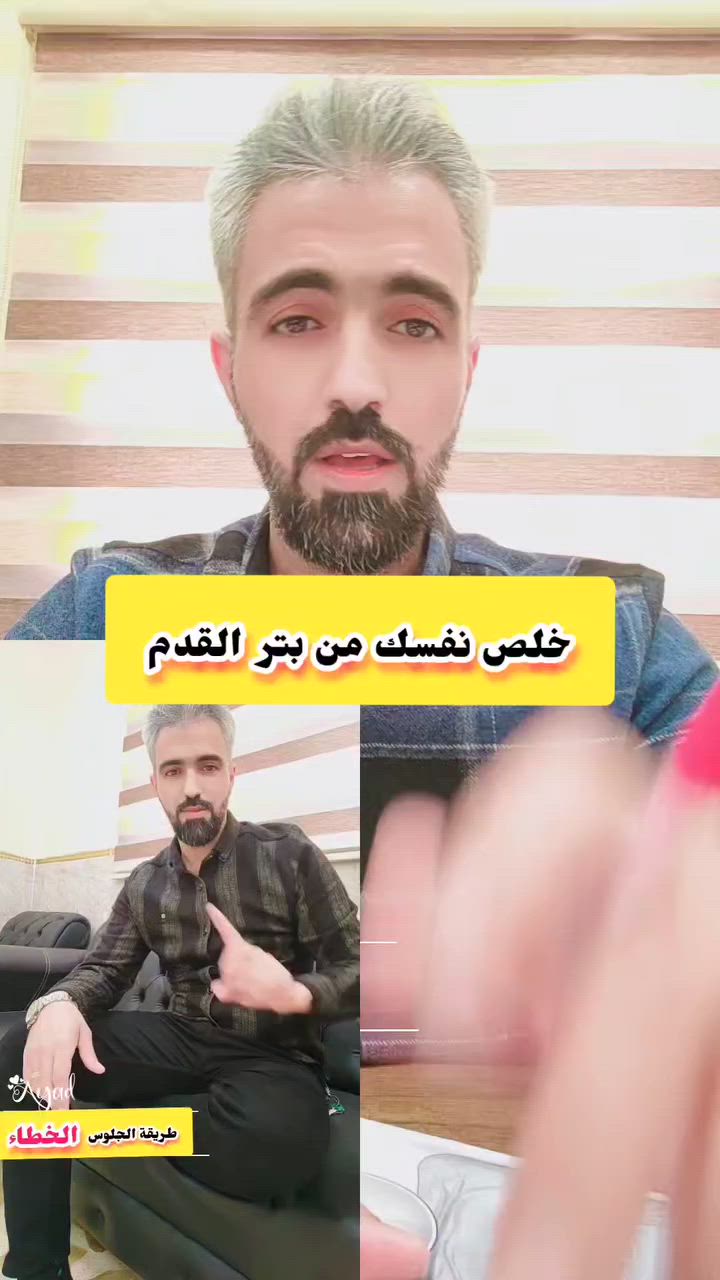 عيادة نابلس التمريضية
تداوي جروح قدم السكري
لنشر جميع الحالات الشفاء التام تابع الروابط

قناة التليكرام لنشر الحالات الشفاء التام
https://t.me/+iPYlW8IqvH5mNDMy

كروب الماسنجر
https://m.me/ch/AbYNYCQfoXvKnBSG/?send_source=cm%3Acopy_invite_link

(كروب مرضى العيادة )واتس اب للتواصل معنا على مدار 24 ساعة
https://chat.whatsapp.com/DJ4IGy8eEhbGlsIf81t0LE

موقع العيادة على گوگل 
https://maps.app.goo.gl/JS46rZrHR6XAcX4H8
صفحة عيادة نابلس التمريضية
https://www.facebook.com/share/1AVMt34Uri/

هاشتاك
#قدم_السكري #علاج_قدم_السكري #جروح_القدم #DiabeticFoot #WoundCare #FootHealth
#تقرحات_الفراش #قرح_الفراش #علاج_الجروح #Bedsores #PressureUlcer #WoundHealing
#علاج_الحروق #حروق_الجلد #عناية_بالحروق #BurnCare #BurnTreatment #SkinHealing
#الخياطة_التجميلية #خياطة_الجرح #ترميم_الندبات #CosmeticSutures #ScarManagement #SutureCare
#معلومات_طبية #تثقيف_صحي #صحة # #HealthAwareness

تك توك 
#fyp
#foryou
#viral
#explore
#trending

#قدم_السكري #diabeticfoot #تثقيف_صحي  
#fyp #viral  
#الموصل #العراق

#قدم_السكري
#السكري
#تثقيف_صحي
#جروح
#العناية_بالقدم
#diabeticfoot
#diabetescare
#woundcare
#medicaleducation
#healthtips

#العراق
#الموصل
#صحة
#نصائح_طبية
#دكتور
#عيادة


**إذا كنت صاحب هذا الإعلان وتريد حذفه لأي سبب، رجاءا أرسل رسالة إلى الدعم الفني**