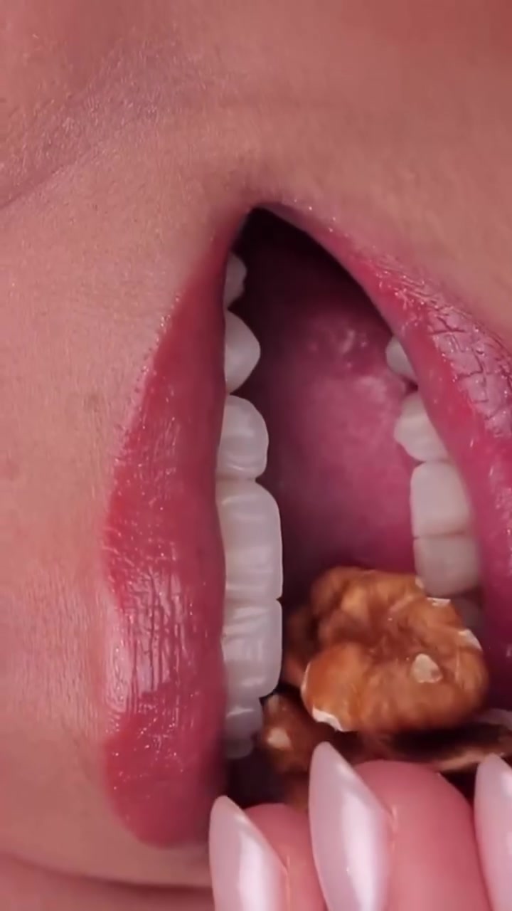 🦷 أسنانك تستحق العناية كل يوم!

لا تنتظر حتى يبدأ الألم، حافظ على ابتسامتك مع الفحص الدوري والعناية الصحيحة.

📍 مركز سما المناذرة لطب الأسنان... ابتسامتك تبدأ من هنا.

العنوان / النجف الاشرف _ المناذرة _ الشارع العام _ قرب مستشفى
 المناذرة _عمارة الحاج ابو نبيل جانب صيدلية الأصالة
 للحجز والأستفسار / ***********
الساعه 9:00 صباحا الساعه 1:00 ظهرا من الساعه 3:30 ظهرا الى الساعه 9:30 ليلا ًَ

#تقويم_اسنان 
#زراعة_الاسنان 
#ابتسامة_هوليود 
#صحة_الفم 
#مراكز_الشركة_الطبية_العالمية
