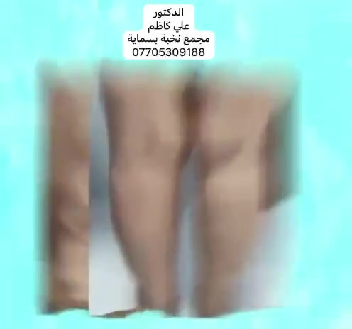 الدكتور علي كاظم
متواجدين اليوم من الساعة 5 الى 9 مساءا

الدكتور علي كاظم
طبيب اختصاص
باطنية-قلبية-صدرية-داء السكري
جراحة القلب والاوعية الدموية
علاج وجراحة الدوالي باحدث الطرق
علاج وجراحة القدم السكري

اوقات الدوام كل ايام الاسبوع عدا الجمعة

للحجز والاستفسار:
***********
***********

العنوان:
بسماية السارع العام المؤدي الى بغداد قرب بوابة بلوك B مجمع نخبة بسماية الطبي مجاور صيدلية ارض الرياحين

#مجمع_نخبة_بسماية_الطبي
#صحتكم_تهمنا
