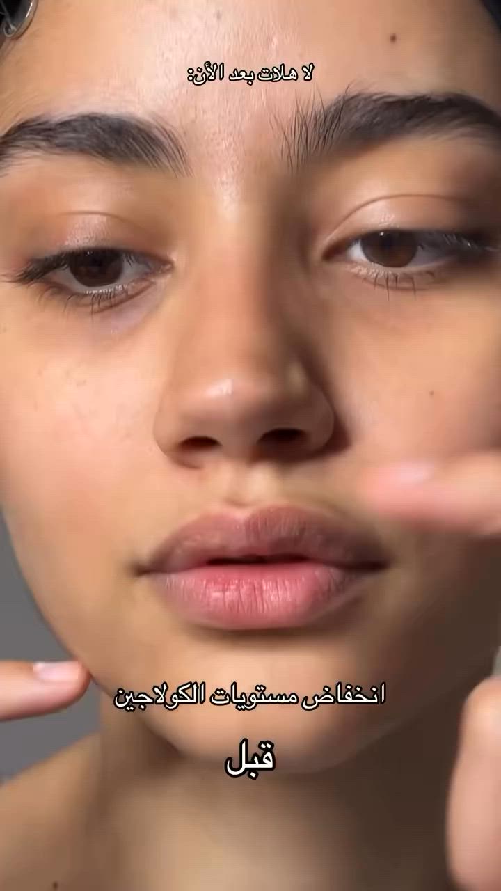 ودّعي الهالات والتعب تحت العين ✨🤍

سيروم الهالات من اكسيس واي يمنح منطقة تحت العين ترطيبًا وإشراقة، ويساعد على تحسين مظهر الهالات والخطوط الرفيعة للحصول على إطلالة أكثر حيوية ونضارة. 🌷

💖 السعر: 20 فقط
📩 الكمية محدودة، احجزي قطعتك الآن قبل النفاد!

#اكسيس_واي #سيروم_الهالات #العناية_بالبشرة #هالات_تحت_العين #بشرة_مشرقة


**إذا كنت صاحب هذا الإعلان وتريد حذفه لأي سبب، رجاءا أرسل رسالة إلى الدعم الفني**