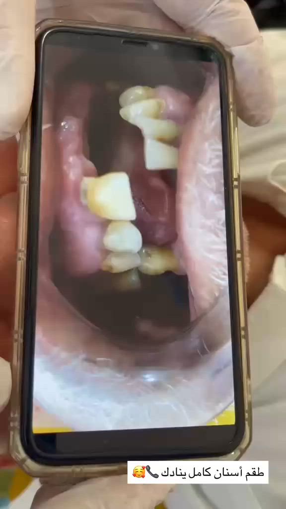 ابتسامتك اجمل مع مركز اسد التخصصي 
***********
