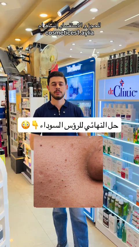 علاج الرؤس السوداء المزعجة ❤️ _______________ سنتر إيليا✨ عنوان السنتر بغداد الحسينية السوق الصغير متوفر توصيل داخل الحسينية وجميع المحافظات #كوزمتك #عنايه_بالبشره #عنايه_بالشعر #مكياج #عنايه_بالجسم 


**إذا كنت صاحب هذا الإعلان وتريد حذفه لأي سبب، رجاءا أرسل رسالة إلى الدعم الفني**