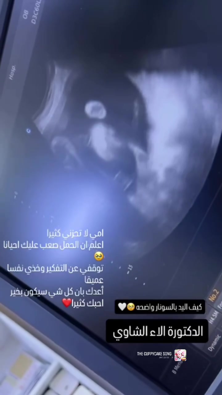 رساله البيبي لك دائما كوني بخير ليكون طفلك بخير أيضا♥️

عيادة الدكتوره الاء الشاوي 
العنوان بغداد الزعفرانية شارع الربيع مقابل مركز التدريب المهني 
عماره مختبر د زينب السعيدي 
***********
