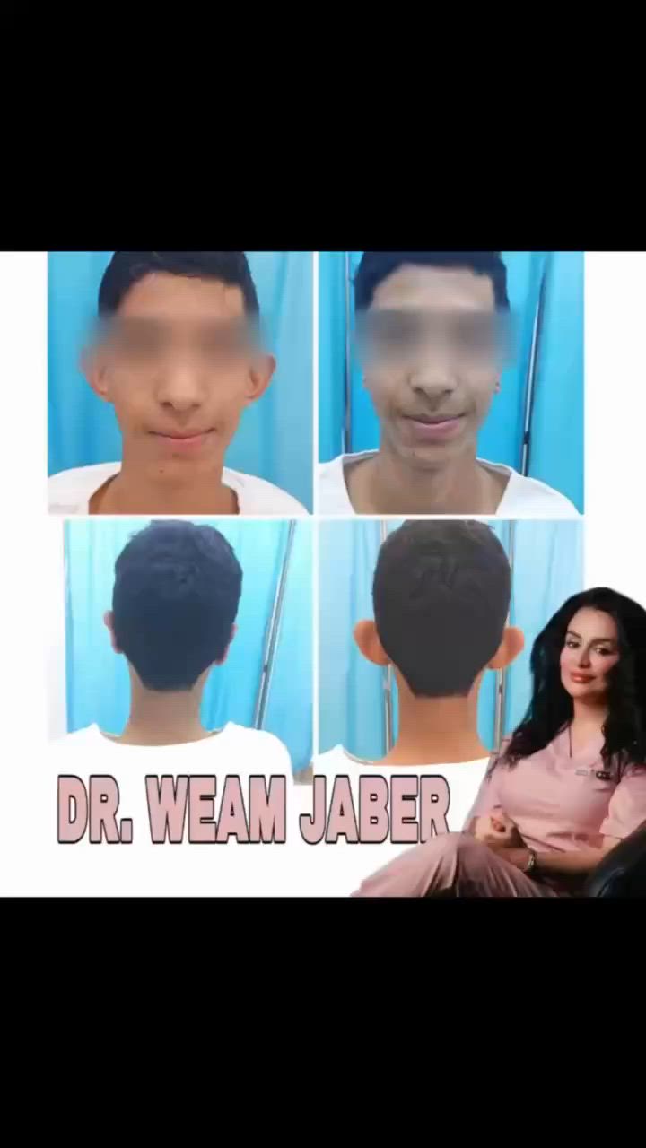 ☀️✨ عروض الصيف المميزة على قسم التجميل ✨☀️

لفترة محدودة ولمدة 10 أيام فقط ⏳
استمتعوا بأقوى عروض التجميل والعناية بالبشرة بأفضل الأسعار 🤍✨

لا تفوتوا الفرصة واحجزوا موعدكم الآن 👌

📍 الموقع: العزيزية – شارع الخليج – جانب البوابة
📞 الهاتف: ***********

مستشفى روح الحياة الأهلي
قسم التجميل
