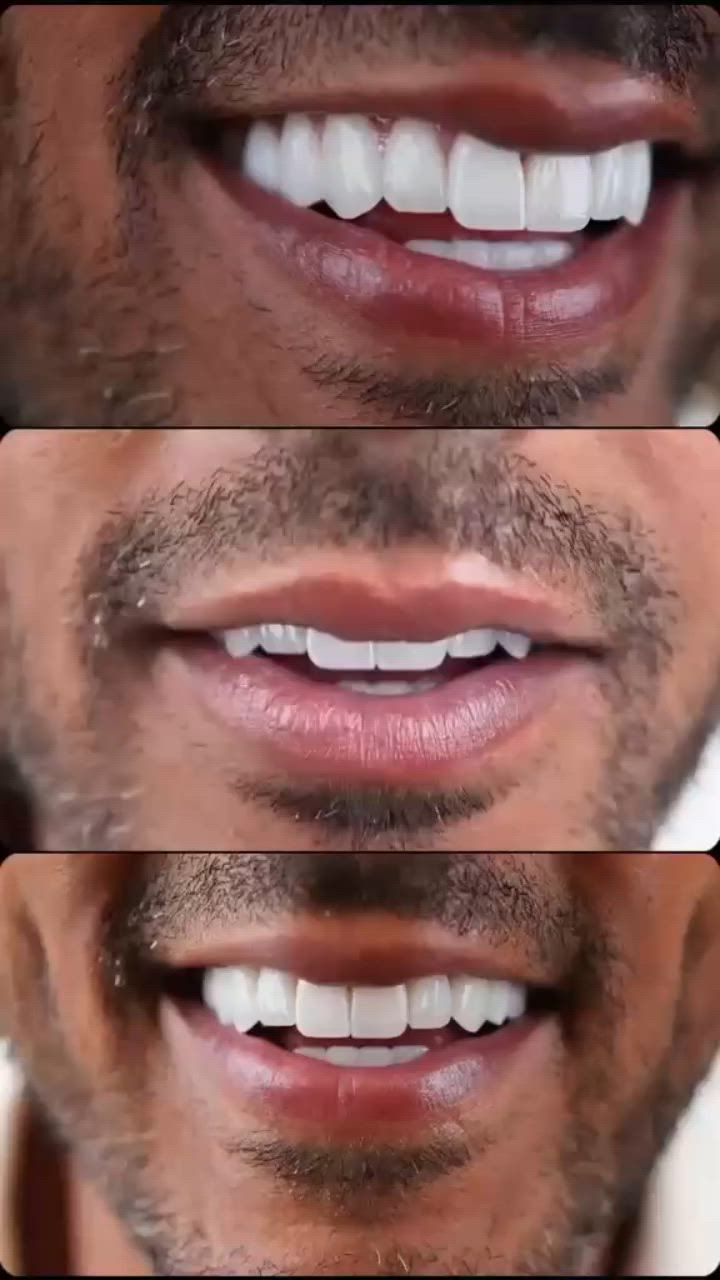 ✨ ابتسامتك تستحق الأفضل ✨

في مركز سما المناذرة لطب الأسنان 🦷
نوفر لكم خدمات تركيب الأسنان بأحدث التقنيات وأجود المواد للحصول على ابتسامة طبيعية وجميلة بثقة عالية.

✅ تركيب ثابت ومتحرك
✅ مظهر طبيعي وألوان مطابقة للأسنان
✅ دقة عالية وراحة تامة
✅ بإشراف كادر طبي متخصص

لا تؤجل ابتسامتك الجميلة...
زوروا مركز سما المناذرة واستعيدوا ثقتكم بابتسامة مشرقة. 🌟

📍 مركز سما المناذرة لطب الأسنان
📞 للحجز والاستفسار العنوان / النجف الاشرف _ المناذرة _ الشارع العام _ قرب مستشفى
 المناذرة _عمارة الحاج ابو نبيل جانب صيدلية الأصالة
 للحجز والأستفسار / ***********
الساعه 9:00 صباحا الساعه 1:00 ظهرا من الساعه 3:00 ظهرا الى الساعه 9:00 ليلا ًَ

سما المناذرة... حيث تبدأ الابتسامة الجميلة.
