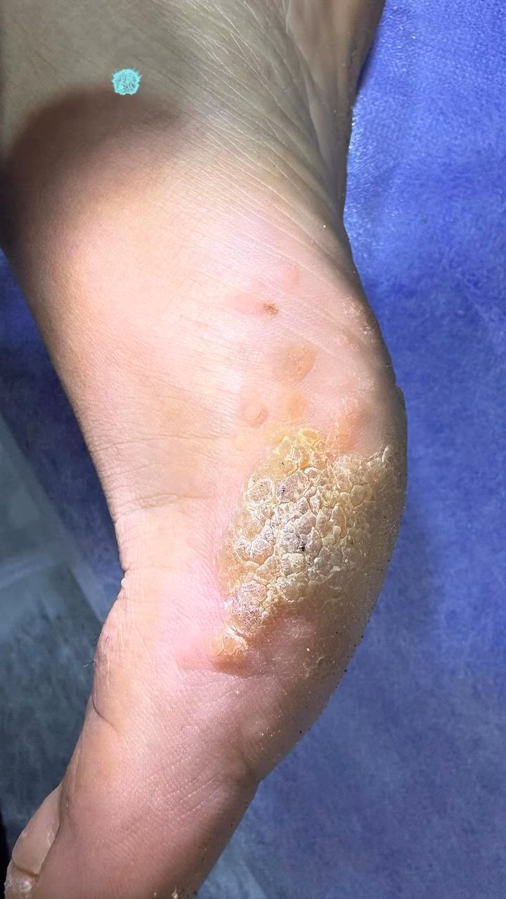 عيادة الامراض الجلديه والتجميل                 
                  الدكتور محمد محسن        
      اختصاصي الامراض الجلديه والتناسليه.                               #دكتوراه(بورد عربي).  
 #Mohamed Mohsen, MD l
اختصاص جراحةوتجميل الجلد   والليزر-بلازما-ميزو-تقشير كيميائي-بوتكس. 
#دبلوم عالي تخصص دقيق في تطبيقات الليزر الطبيه والبايلوجيه.
الرمادي -شارع الاطباء-مجاور صيدلية ابن سيناء-للحجز-***********
