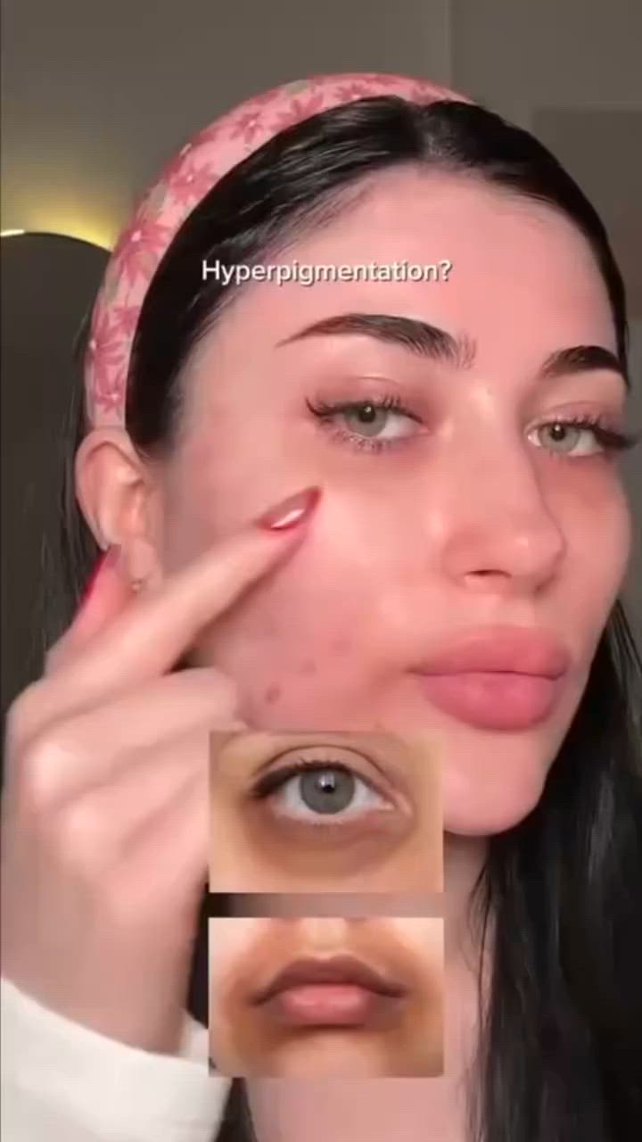 شوفو شنو توفر عندنا 😍😍

Arencia – Face & Eye Cream Moisturizer
✨ Vitamin C Booster Shot ✨
كريم خفيف وعملي يخدم كـ Booster بفيتامين C، ينفع للوجه وتحت العين في نفس الوقت 👌
💛 تركيبة ذكية تعطيك إشراقة وترطيب بدون ما تحسي بثقل أو دهنية

يحتوي على :
✔️ Vitamin C Complex (5%) → إشراقة واضحة + توحيد لون البشرة
✔️ Glutathione → يساعد على التخفيف من التصبغات ويزيد النضارة
✔️ مرطّبات خفيفة → ترطيب مريح بدون ما يسد المسام

الفوائد:
✨ يعطي إشراقة من أول استعمال
🎯 يساعد تدريجياً على تقليل البقع والتصبغات
👁️ يخفف مظهر التعب والهالات تحت العين
💧 يرطّب البشرة بدون إحساس دهني

😍 مناسب للاستعمال اليومي، خصوصاً لو تبي نتيجة ناعمة وبشرة حيوية
المنشأ كوريا الأصلي 🇰🇷


**إذا كنت صاحب هذا الإعلان وتريد حذفه لأي سبب، رجاءا أرسل رسالة إلى الدعم الفني**