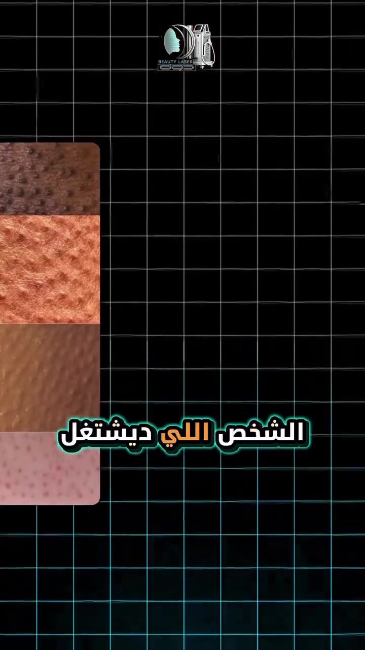 مو كل ليزر آمن… والخطأ ممكن يترك أثر 💔
حروق الليزر مو صدفة… غالباً نتيجة استخدام غير صحيح ⚠️
الجمال يحتاج خبرة… مو مجرد جهاز ✨
اختاري المكان الصح حتى تحمين بشرتك 🤍
✨️عيادات دوّل للتجميل بإشراف د.مــسلم المــسعــودي 
📍كربلاء حي الحسين شارع كاتب عدل قرب مطعم الدر النصراوي 
*********** 📞

