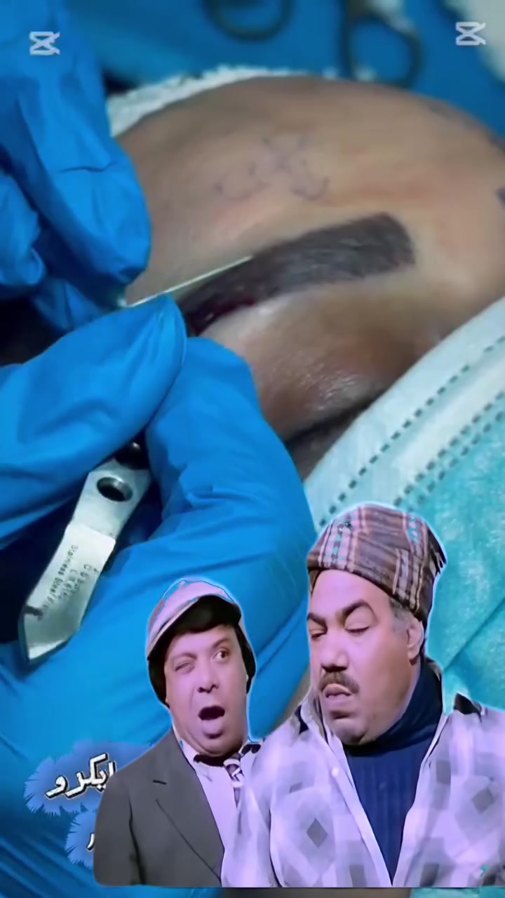 مو كل حواجب مزروعة… تبين طبيعية!

الفرق مو بالزراعة…
الفرق باتجاه كل شعرة.

بمركز المنصور
نهتم بأدق التفاصيل 
ونستخدم أحدث التقنيات
 حتى تحصل على حواجب
✔️ طبيعية، 
✔️مرتبة، 
ونتيجتها تبين من نفس يوم الجلسة.

لأن هدفنا مو بس نزرع… هدفنا نخلي النتيجة كأنها خلقية.

للحجز والاستفسار الاتصال ع لارقام
الاداره ***********
قسم المتابعه ***********

او زورونا بموقع العياده
بغداد المنصور شارع الرواد مقابل مرطبات مشمشه

