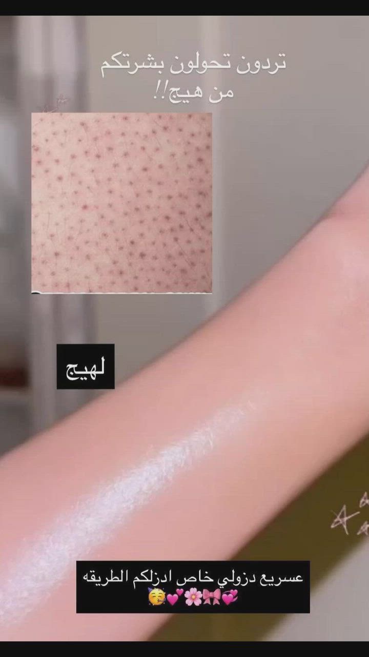 دزولي رسايلكم خاص بنات#عنايه_بالجسم #جلد_الوزه #reels #مشاكل_البشرة


**إذا كنت صاحب هذا الإعلان وتريد حذفه لأي سبب، رجاءا أرسل رسالة إلى الدعم الفني**