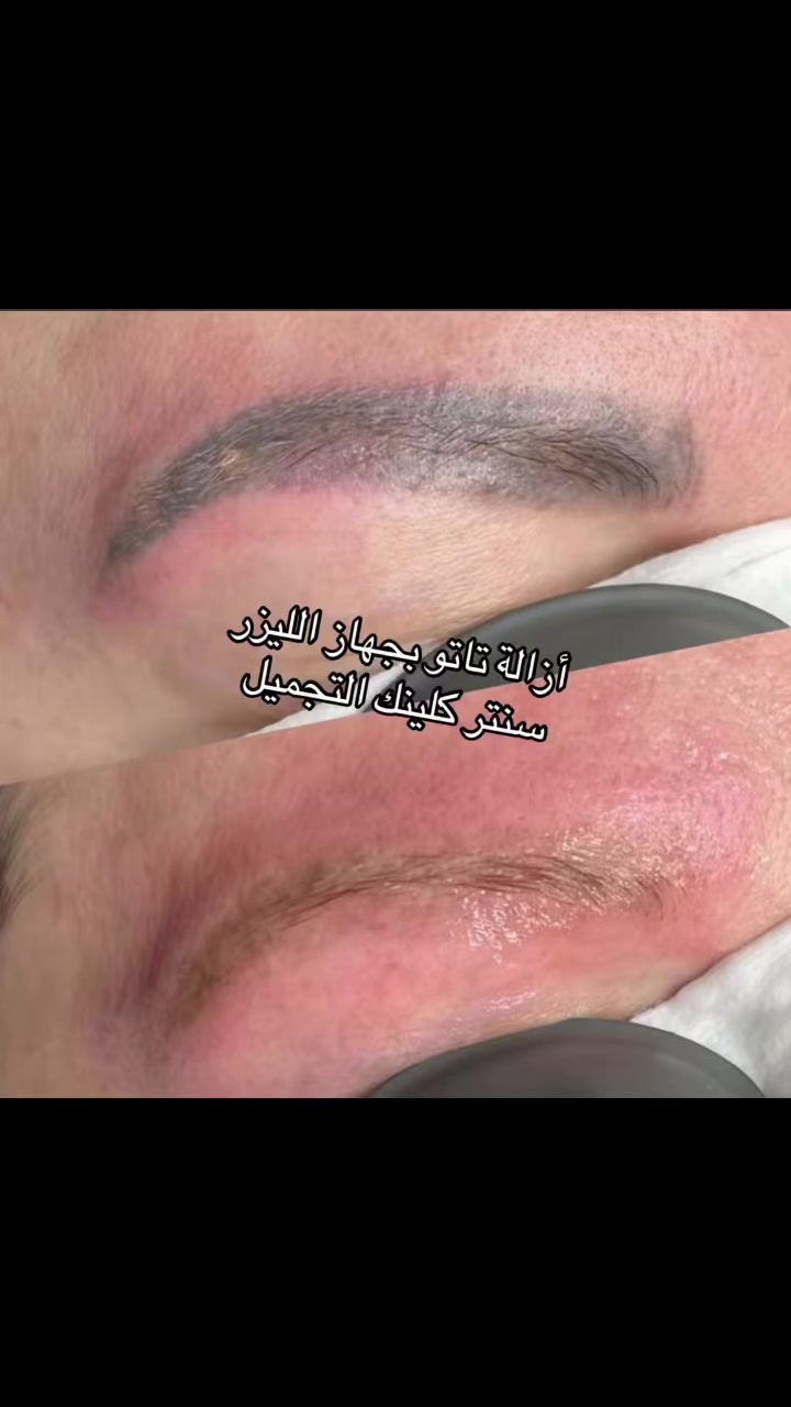 📍 العنوان:
بغداد الجديدة – شارع المسبح، مقابل سوبر ماركت آدم للتسوق، مجاور أم رقية.
📞 للحجز والاستفسار:
***********
