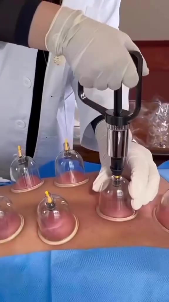 🌿 الحجامة النبوية بالطريقة الحديثة بالإبر الماليزية 🌿
لأن صحتك تستحق الأفضل، نقدم جلسات حجامة احترافية تجمع بين هدي السنة النبوية وأحدث الأساليب الحديثة، باستخدام الإبر الماليزية المعقمة أحادية الاستخدام، مع تطبيق أعلى معايير التعقيم والسلامة.
✨ نحرص على تقديم جلسة مريحة وآمنة في بيئة نظيفة وخصوصية تامة، مع الاهتمام بكل تفاصيل راحتك.
✔️ تعقيم كامل قبل وبعد الجلسة.
✔️ أدوات وإبر للاستخدام مرة واحدة فقط.
✔️ تطبيق احترافي وفق الأصول الصحيحة.
✔️ جودة، أمان، وثقة.
📞 للحجز والاستفسار، راسلنا عبر الخاص أو اتصل بنا، ويسعدنا خدمتك.
اتصال: ***********
واتساب:***********
#حجامة_النور_النبوية
العنوان/الموصل الجانب الأيمن والأيسر
