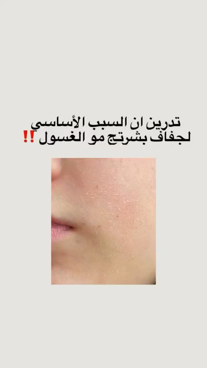 عنايه بشرتج
كوزمتك المنتجات الكورية الاصلية

#viralpost
#tiktokfamous
#featureme
#trend
#levelup
#new
#like
#share


**إذا كنت صاحب هذا الإعلان وتريد حذفه لأي سبب، رجاءا أرسل رسالة إلى الدعم الفني**