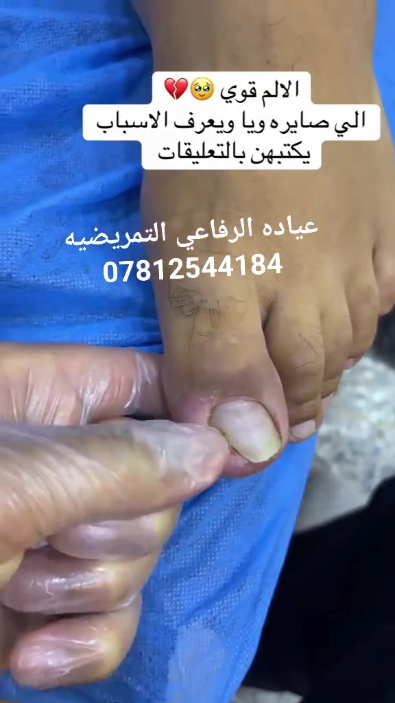 #عياده الرفاعي التمريضيه 💪🏼🩺 خدمه منزليه متوفره
