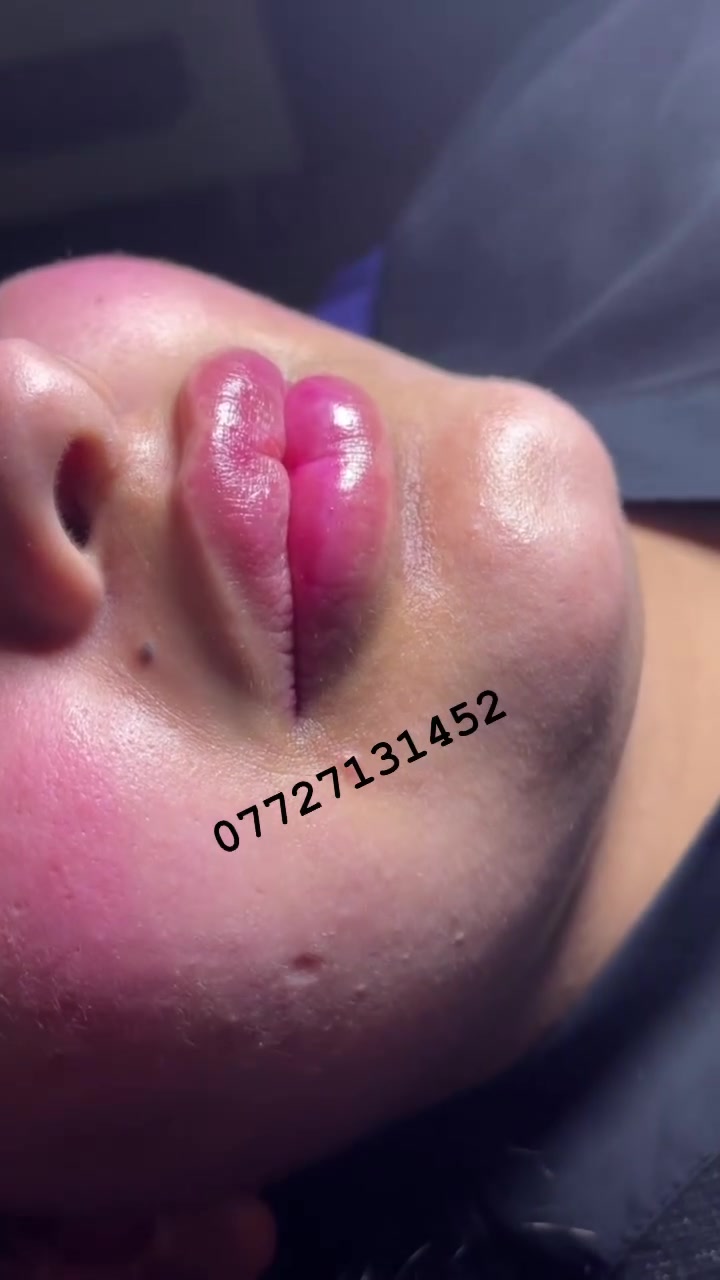 💋 شفايف ممتلئة... بأنوثة ولمسة طبيعية! 💖
إذا تحلمين بشفايف متناسقة وجذابة بدون مبالغة، فهذا هو الوقت المناسب! ✨
🌸 فلر الشفاه يمنحك: ✔️ امتلاء طبيعي ✔️ ترطيب ونضارة ✔️ تحديد جميل للشفاه ✔️ نتائج فورية بإشراف مختصين
📍 سكن كير لليزر والتجميل 📞 ***********
احجزي موعدك الآن، وخلي جمال ابتسامتك يحچي عنك! 💕
#حقن #بوتكس #جلديه #فلر @إشارة
سكن كير لليزر والتجميل
عيادات الرحمة الطبية
مجمع عيادات الرحمة الطبي
مختبر الرحمة الطبي 
سكن كير
@
