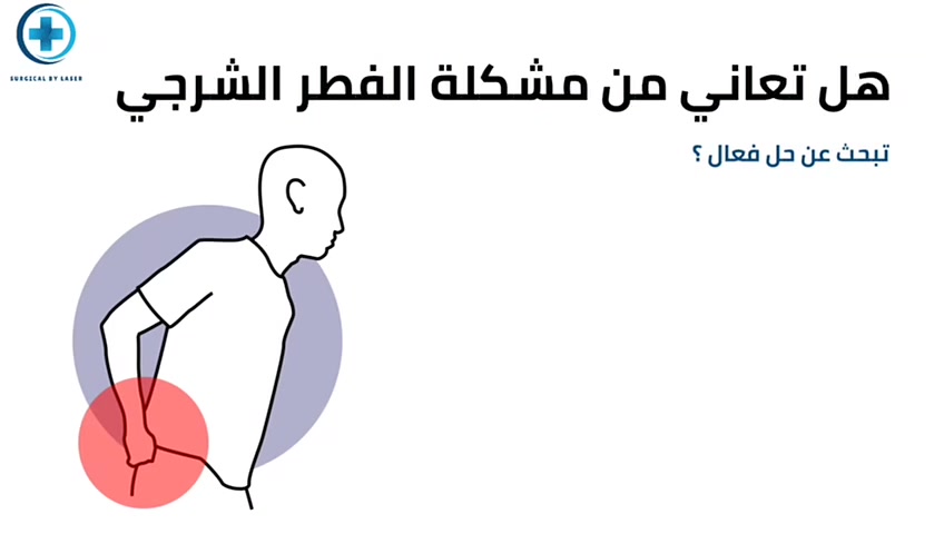 ‏🔹 الفطر أو الشرخ الشرجي
‏
‏ألم أثناء التبرز؟ نزف أو حرقان مستمر؟
‏
‏لا تتحمل الألم أكثر...
‏
‏بعيادات لافين نوفر علاج الشرخ الشرجي (الفطر) بتقنية الليزر الحديثة:
‏
‏✅ بدون ألم
‏✅ بدون فتيلة أو ضماد
‏✅ تخدير موضعي
‏✅ إجراء سريع خلال 20 دقيقة
‏✅ خروج بنفس اليوم
‏✅ راحة وتحسن سريع
‏
‏ارجع لحياتك الطبيعية بدون معاناة.
‏
‏📍 بغداد – شارع فلسطين – تقاطع الصخرة
‏📞 ***********
‏📞 ***********
‏
‏#الشرخ_الشرجي #الفطر_الشرجي #علاج_بالليزر #عيادات_لافين #بغداد
‏
‏
