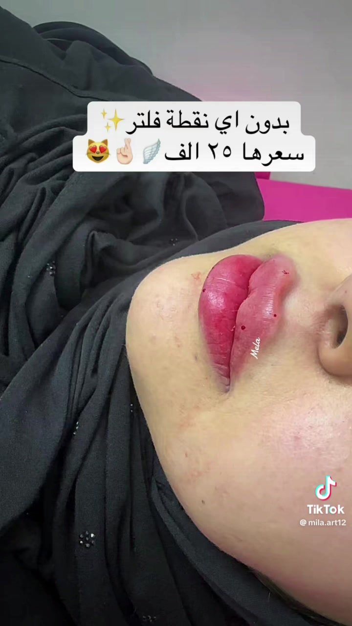 اهلا وسهلا جميلتنا عروض سبوت صبغ وتخصيل مع معالج مع بدكير مع قص مع شسوار ٤٠ العرض الثاني صبغ مع معالج مع تنضيف قدم مع معالج ٢٥ تنضيف قدم ٥جلش ٥قص ٥رموش ١٥ تنضيف بشره ١٠ معالج وتسريحً٥٠ جل اكستنشن ٢٠ العامريه شارع المضيف مقابيل كافي ليمونه طابق *********** اهلا وسهلا جميلتنا

