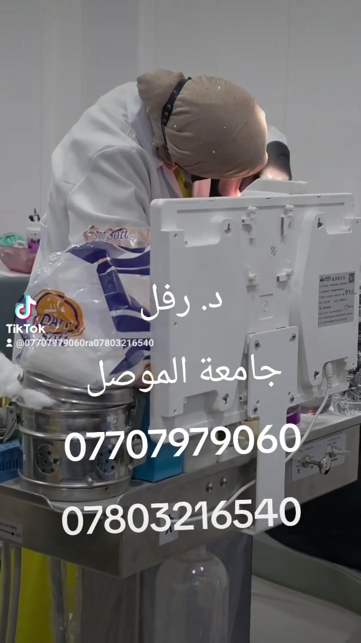 @أبرز المعجبين 
عملية قلع EXO
وتغليف الاسنان الامامية باستخدام الطبعة الرقمية
 بالتعاون مع مختبر نبض بيجي لتكنلوجيا صناعة الاسنان 
مختبر الفقراء
تحت اشراف الدكتورة رفل كامل محمود
جامعة الموصل 
نرسم الابتسامة بطريقة الصحيحة 
معأ نصنع القرار
***********
***********
