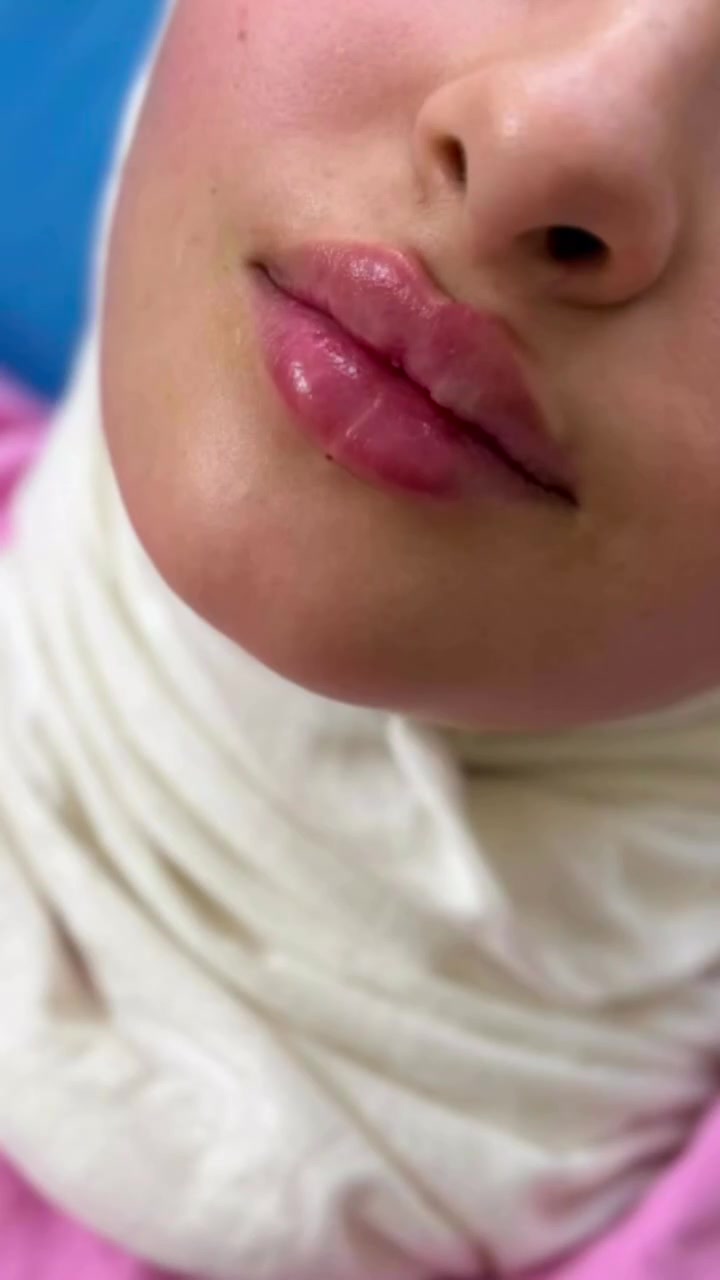 #عيادة فلورا للتجميل والليزر والاسنان 

#جلسه فلر شفه حسب طلب المراجعة ❤️

 #العنوان؛ طوز _ سوك الجمهوريه  _ مجاور ملبوسات مختار 
طابق تأني لجامعة 
الرقم؛ ***********📞

#علما_ليس_لدينا_فرع_اخر 🧿
