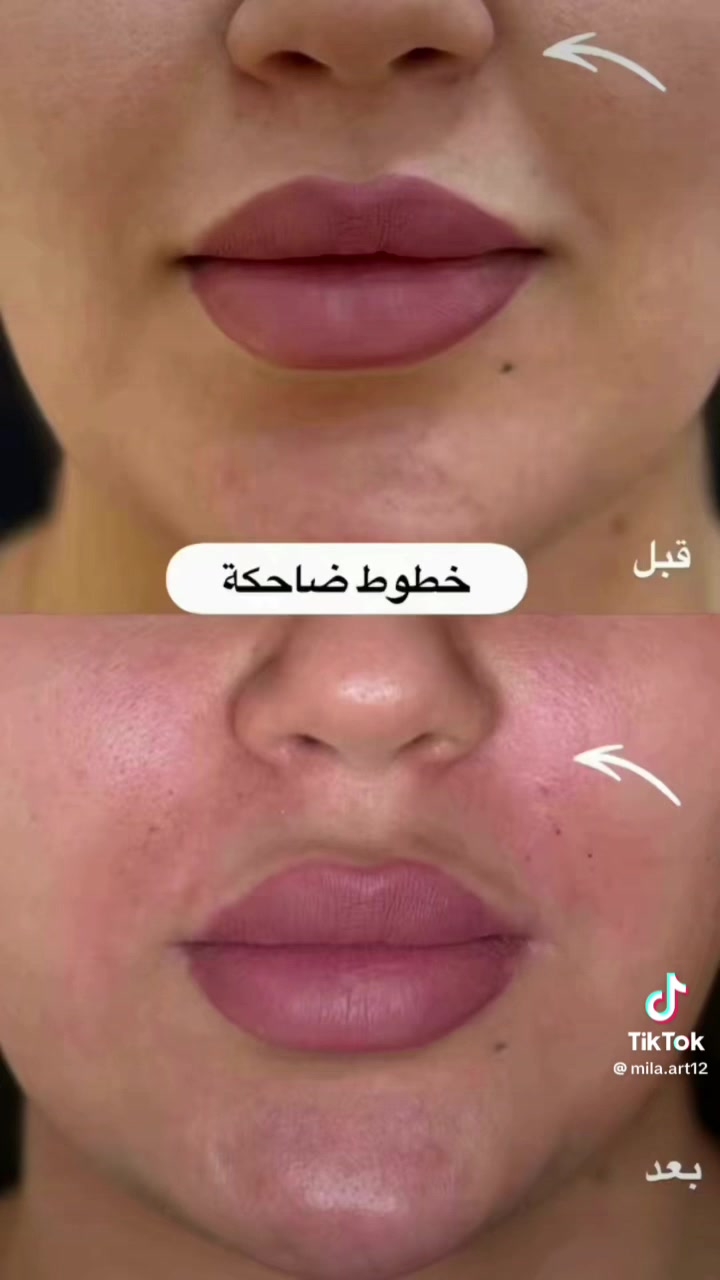 اهلا وسهلا جميلتنا عروض سبوت صبغ وتخصيل مع معالج مع بدكير مع قص مع شسوار ٤٠ العرض الثاني صبغ مع معالج مع تنضيف قدم مع معالج ٢٥ تنضيف قدم ٥جلش ٥قص ٥رموش ١٥ تنضيف بشره ١٠ معالج وتسريحً٥٠ جل اكستنشن ٢٠ العامريه شارع المضيف مقابيل كافي ليمونه طابق *********** اهلا وسهلا جميلتنا
